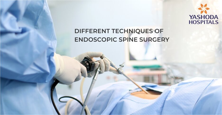 Minimally Invasive Endoscopic Spine Surgery Best Treatment For Spinal