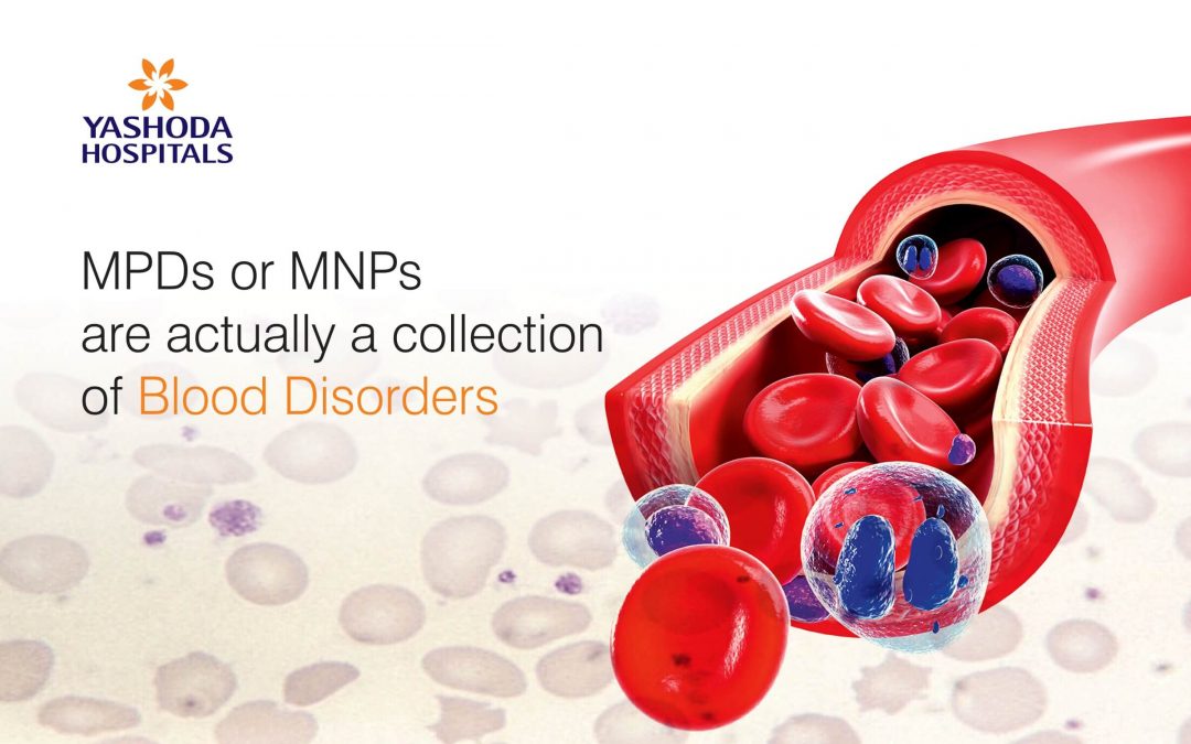 Myeloproliferative disorders (MPD)