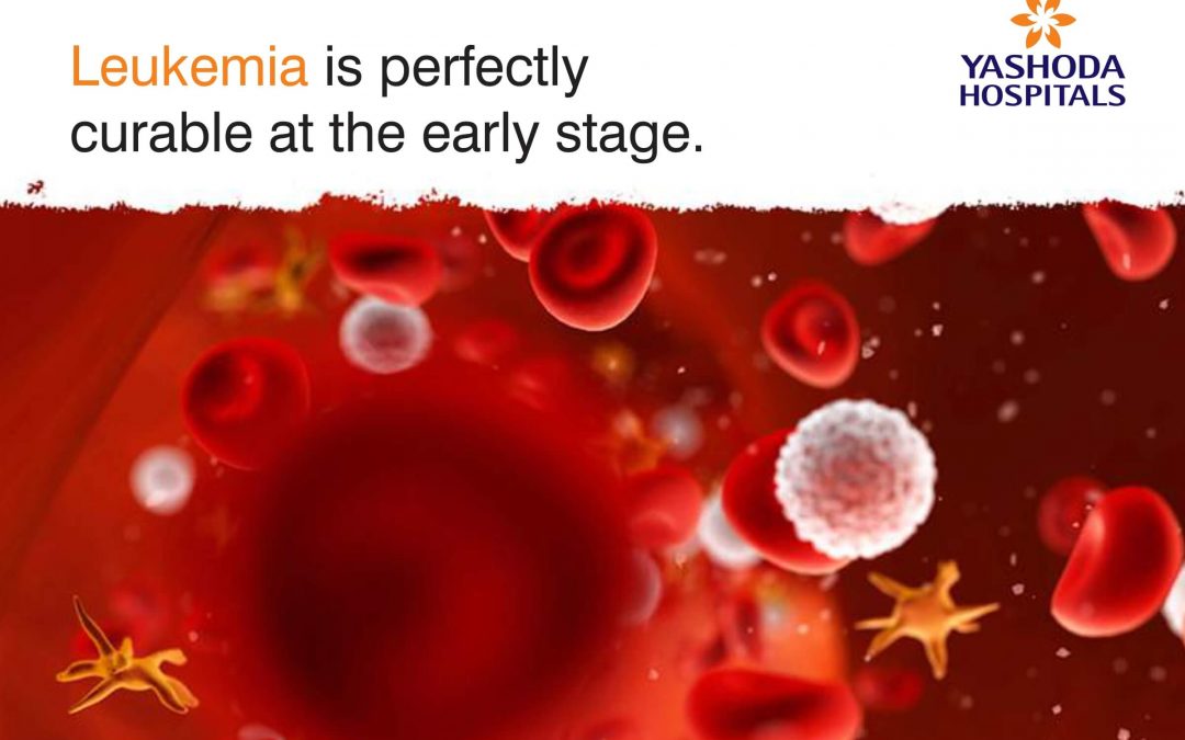 Leukemia is perfectly curable at the early stage