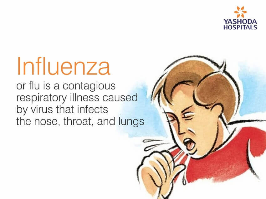 Influenza