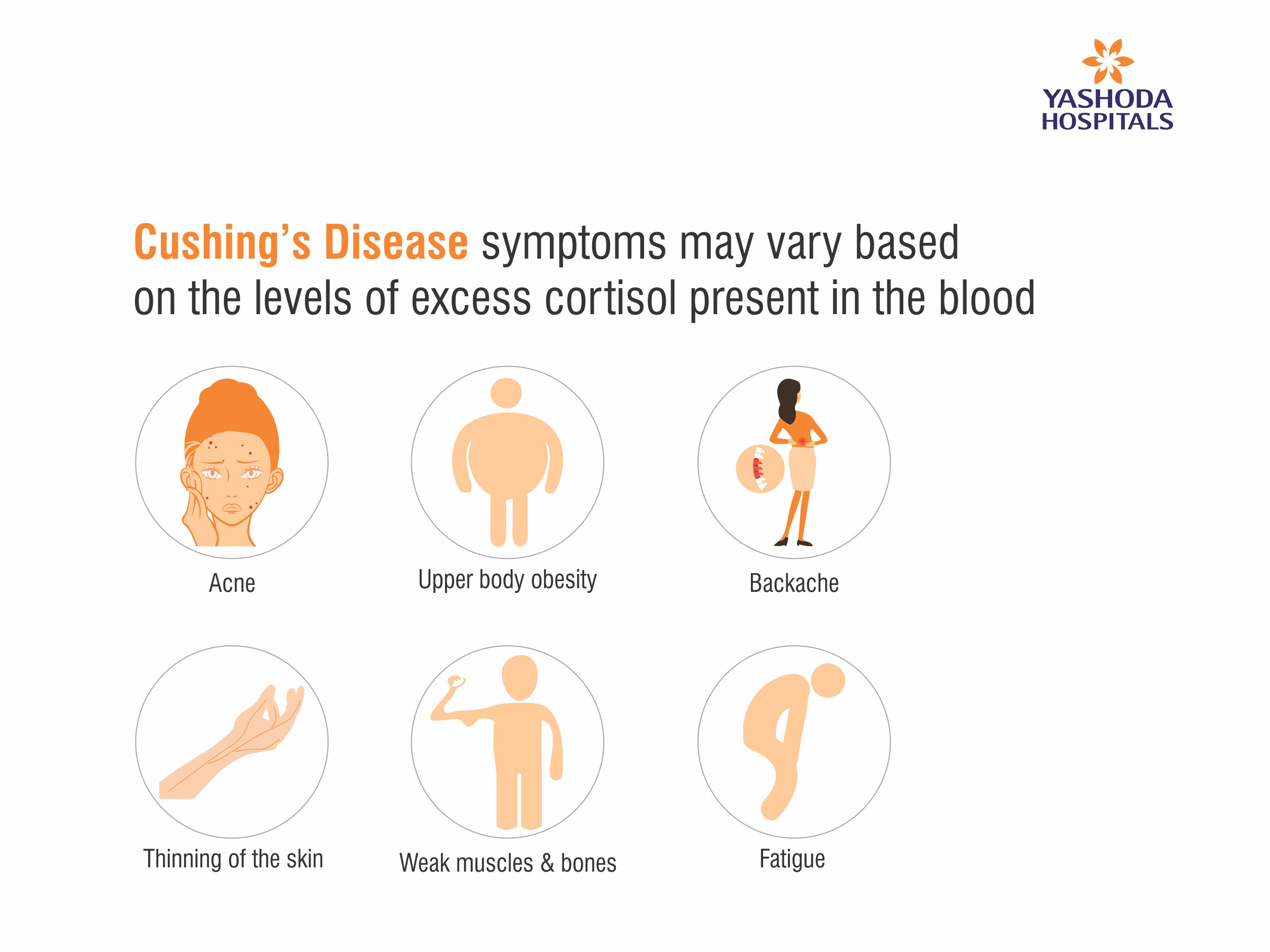 What Is Cushings Disease Yashoda Hospitals Symptoms And Treatment 