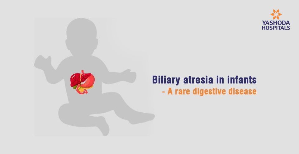 How to treat Biliary atresia, a rare digestive disease in infants?