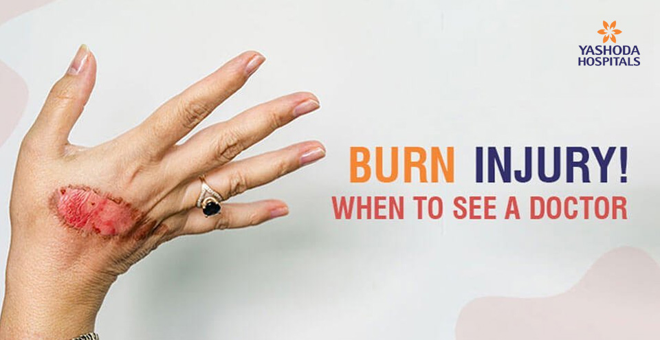 Burn injury: When to seek emergency medical care