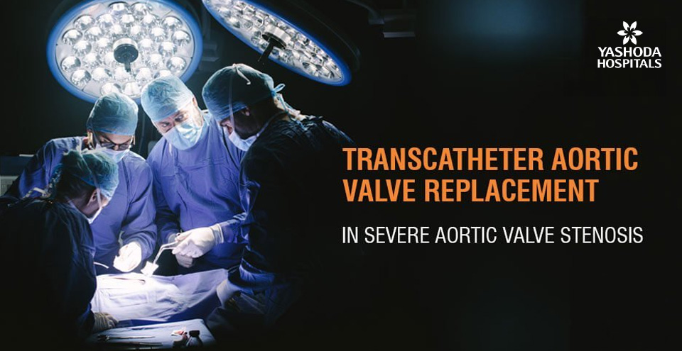 Transcatheter Aortic Valve Replacement (TAVR) for severe aortic valve stenosis