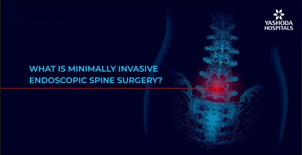 What is Minimally invasive spine surgery (MISS)?