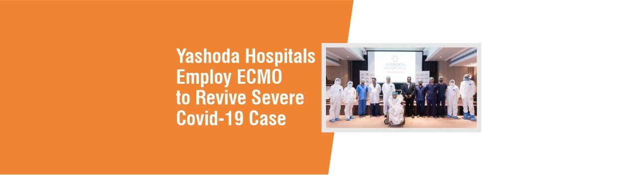 Yashoda Hospitals employ ECMO to revive severe Covid