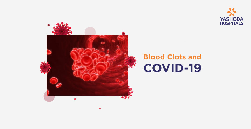 Blood Clots and COVID-19