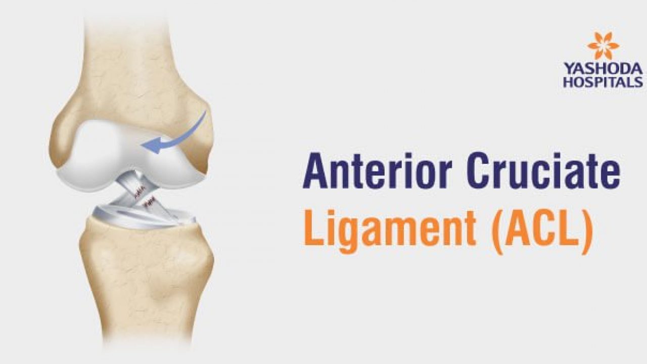 Torn Anterior Cruciate Ligament (ACL)  Central Coast Orthopedic Medical  Group