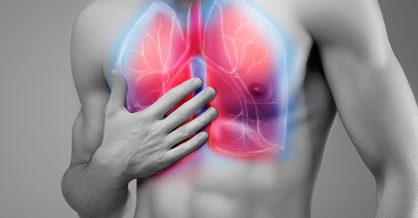 How to diagnose and treat Acute Respiratory Distress Syndrome?