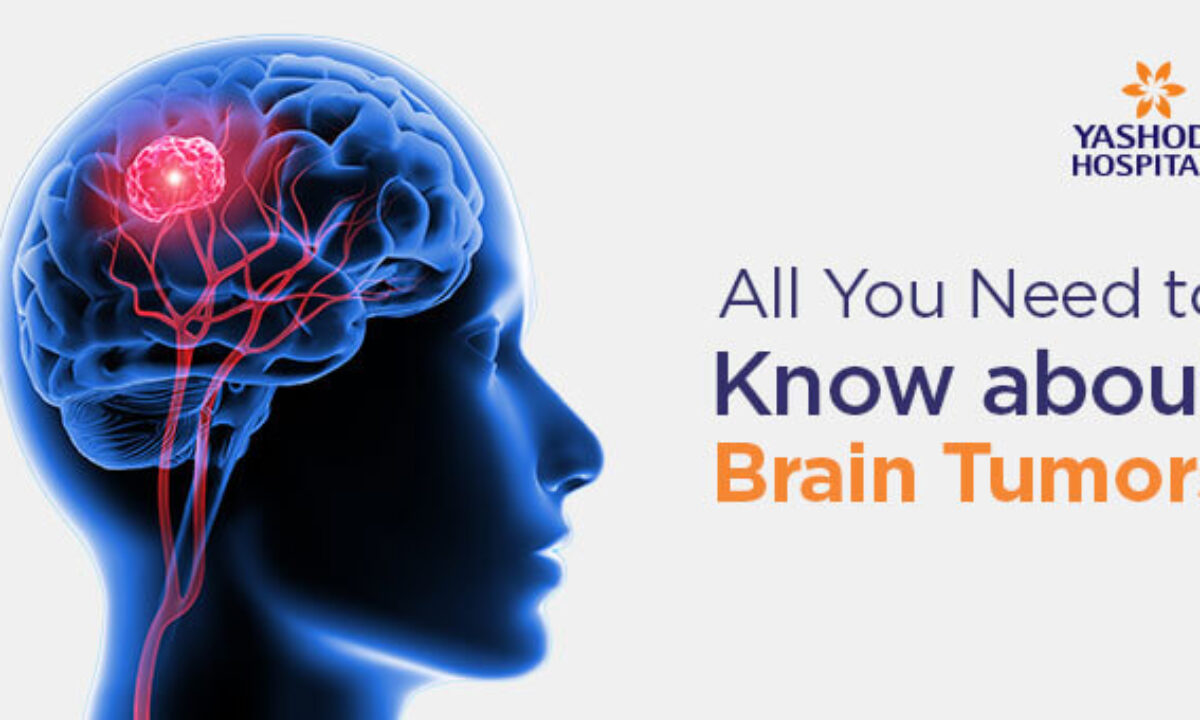 All You Need to Know about Brain Tumors