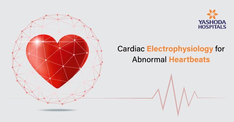 Electrophysiology Studies (EPS)