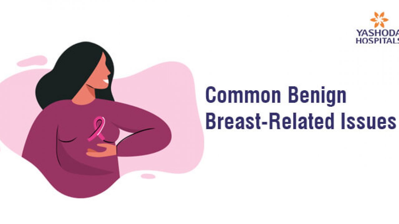Common Benign Breast Related Issues
