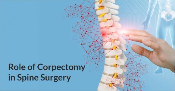 Role of Corpectomy in Spine Surgery - Dr. Venkata Ramakrishna T