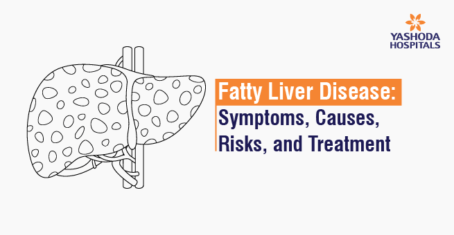 Fatty Liver Disease: Symptoms, Causes, Risks, and Treatment