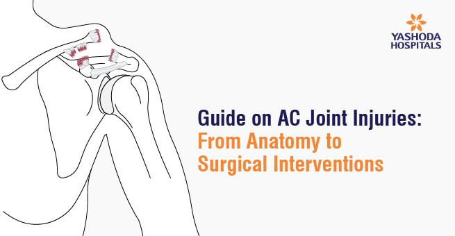 Guide on AC Joint Injuries