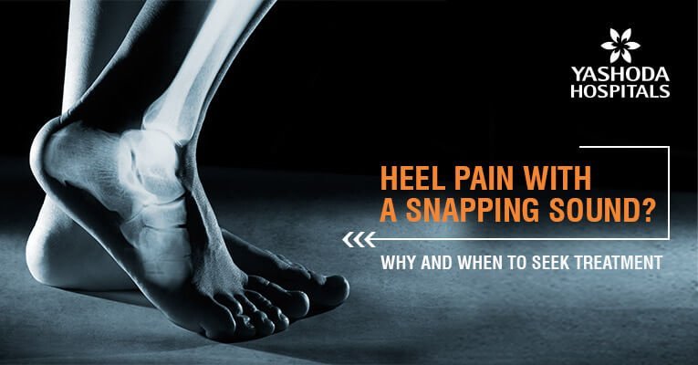 How to treat heel pain with a snapping sound?