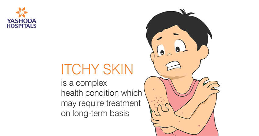 Itchy Skin