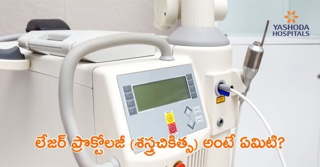 పైల్స్ లేదా హేమోరాయిడ్స్ (Hemorrhoids), ఫిస్టులా (Fistula) కోసం అధునాతన లేజర్ చికిత్స