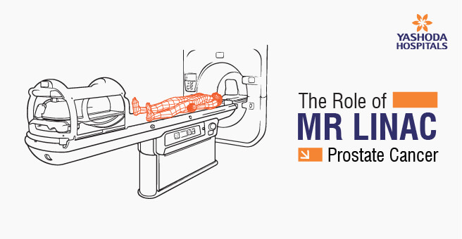 The Role of MR Linac in Prostate Cancer