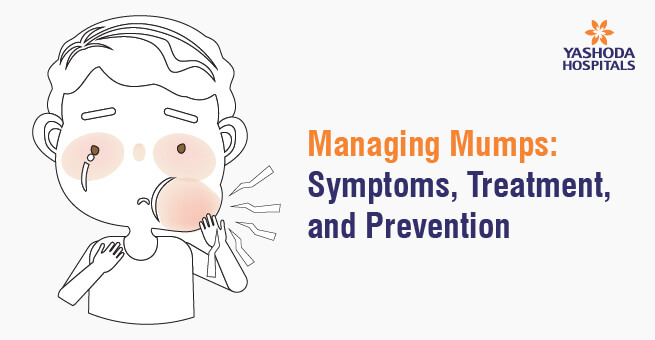 Managing Mumps: Symptoms, Treatment, and Prevention