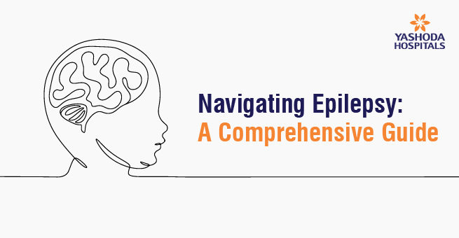 Navigating Epilepsy A Comprehensive Guide blog banner