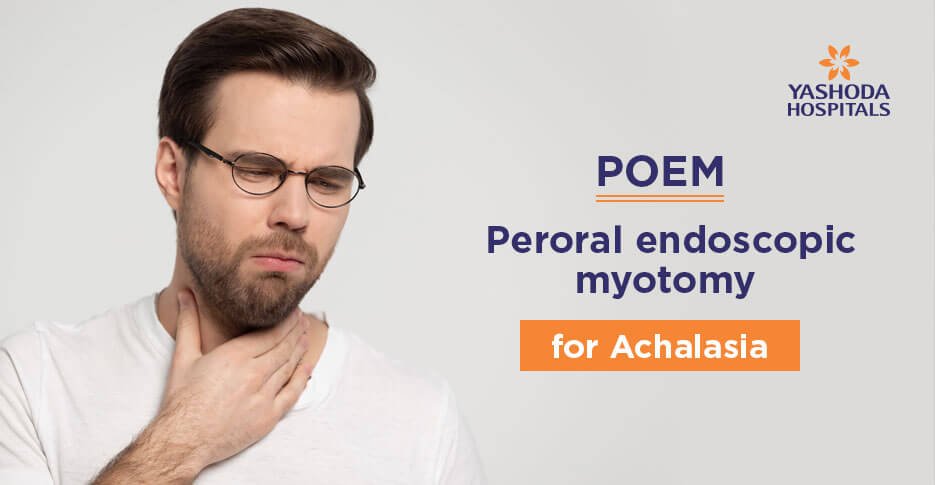 Peroral endoscopic myotomy (POEM) for Achalasia