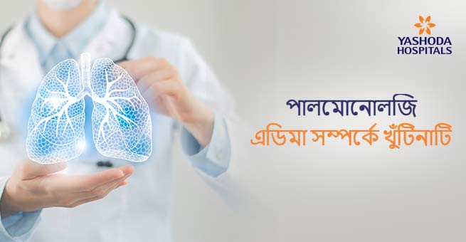 পালমোনোলজি এডিমা সম্পর্কে খুঁটিনাটি