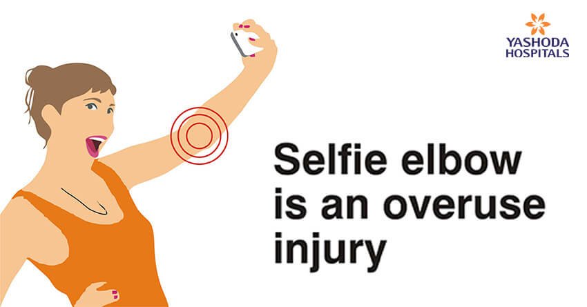 Selfie Elbow