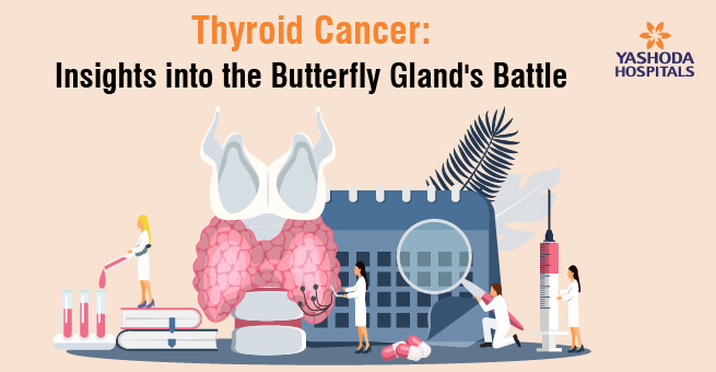 Thyroid Cancer: Insights into the Butterfly Gland’s Battle