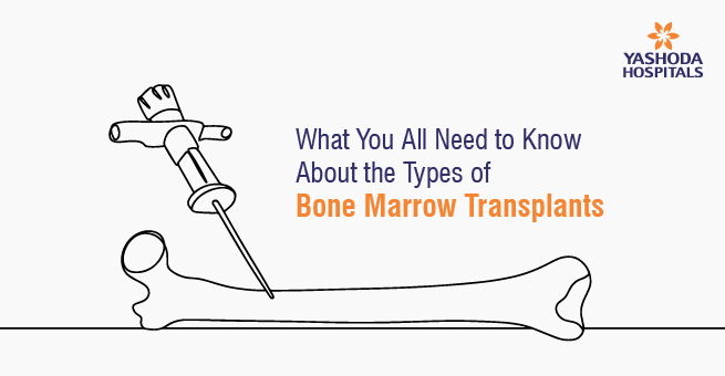 What You All Need to Know About the Types of Bone Marrow Transplants