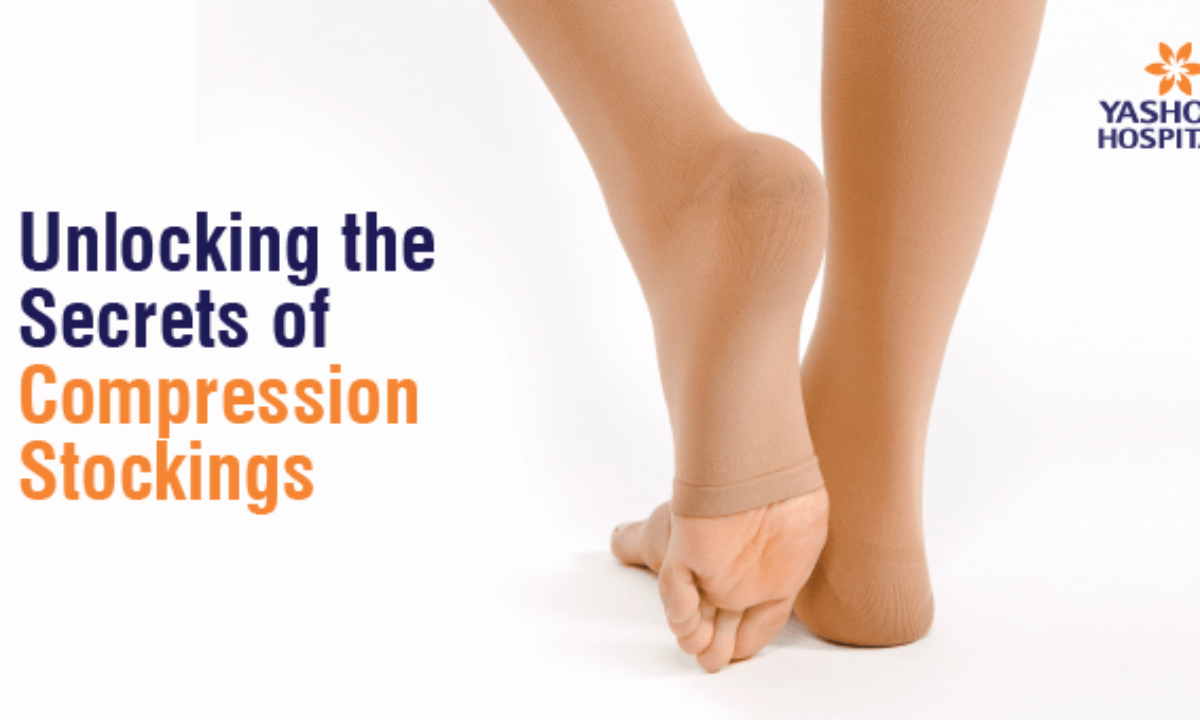 Compression Stockings vs. Surgery Benefits & Choosing Wisely