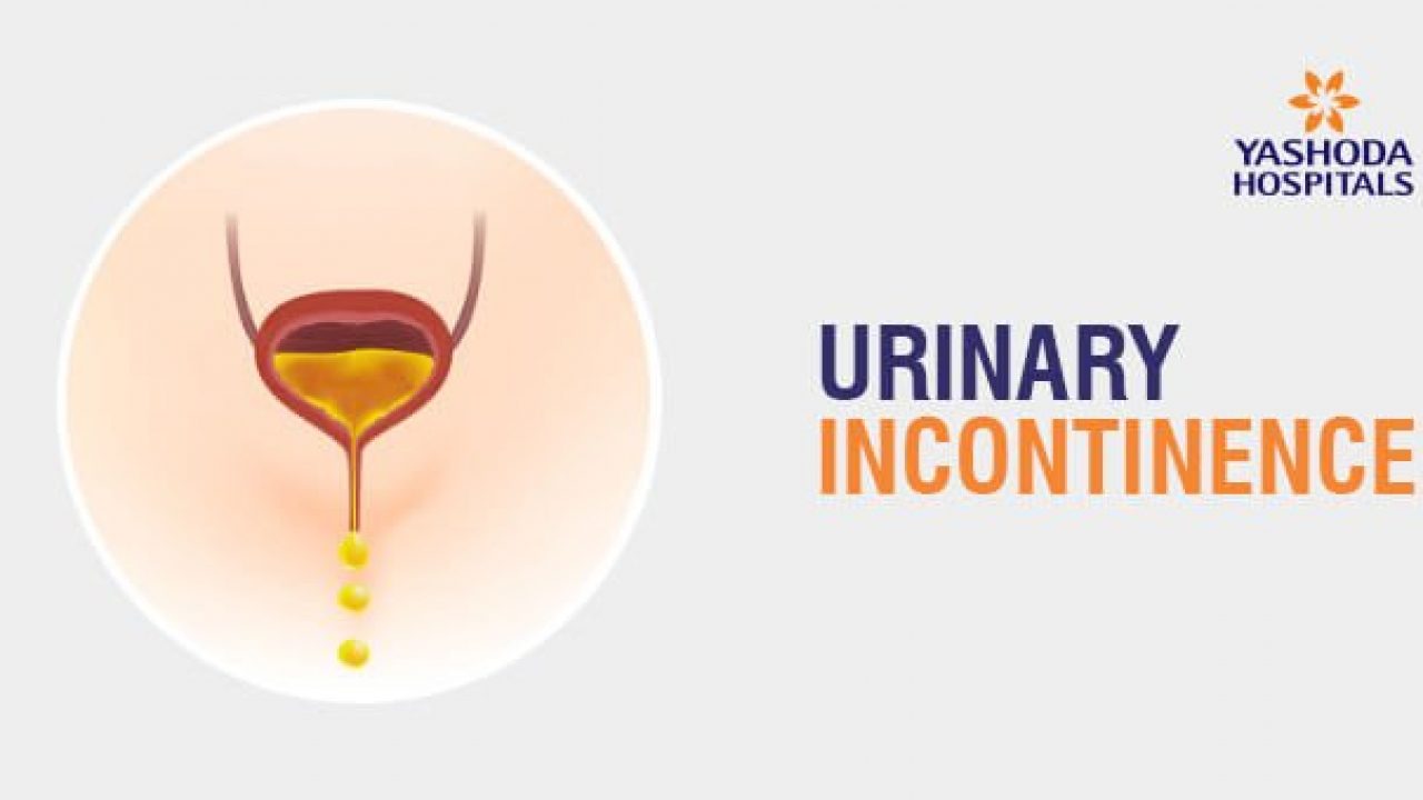 Surgery for stress urinary incontinence in women - Mayo Clinic
