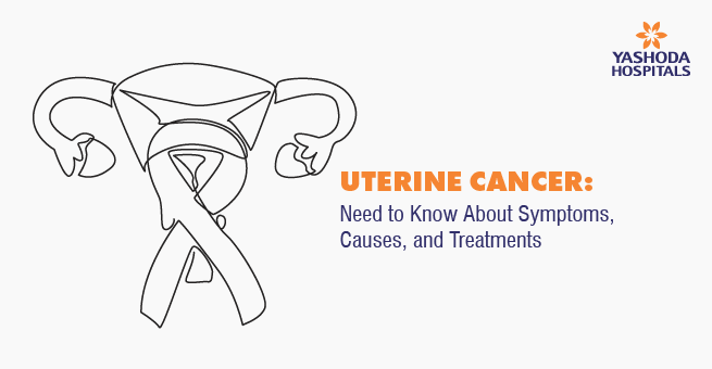 Uterine Cancer: Need to Know About Symptoms, Causes, and Treatments