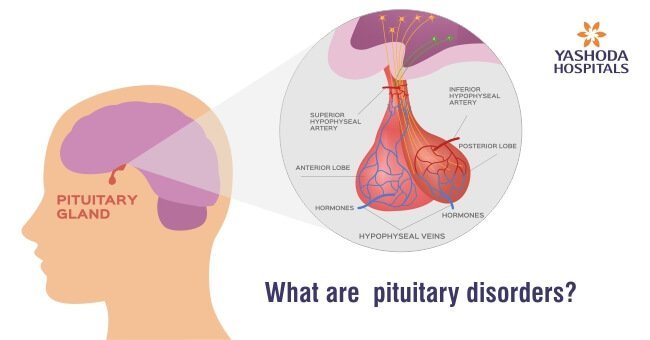 How to diagnose and cope with the side-effects of treatment for pituitary tumours?