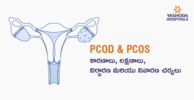 PCOD & PCOS: కారణాలు, లక్షణాలు, నిర్ధారణ మరియు నివారణ చర్యలు