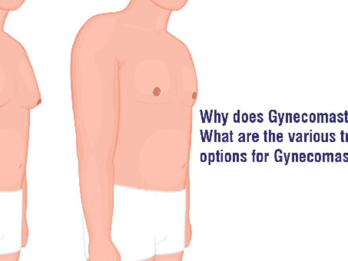 Enlarged male breast | Gynecomastia | Treatment | Yashoda Hospitals