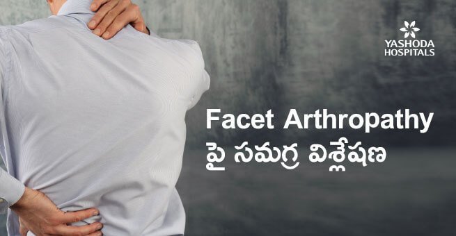 Facet కీళ్ళ వ్యాధి (Facet Joint Arthropathy) అంటే ఏమిటి మరియు ఎలా చికిత్స చేస్తారు?