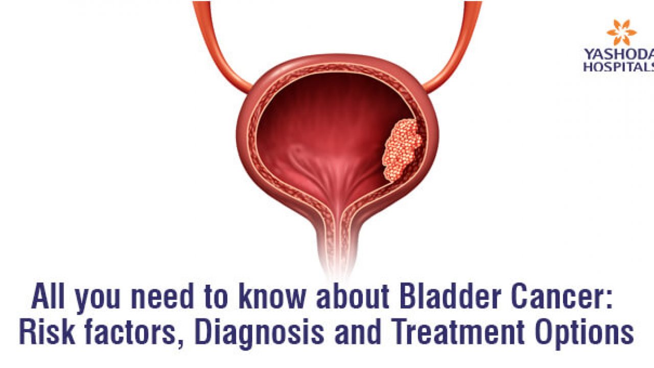 May is Bladder Cancer Awareness Month! » Department of Urology