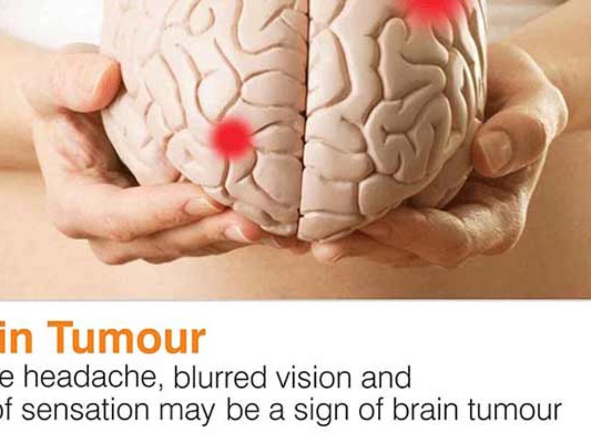 How Would You Know If You Had A Brain Tumor