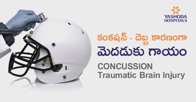 కంకషన్(Concussion), దెబ్బ కారణంగా మెదడుకు గాయం