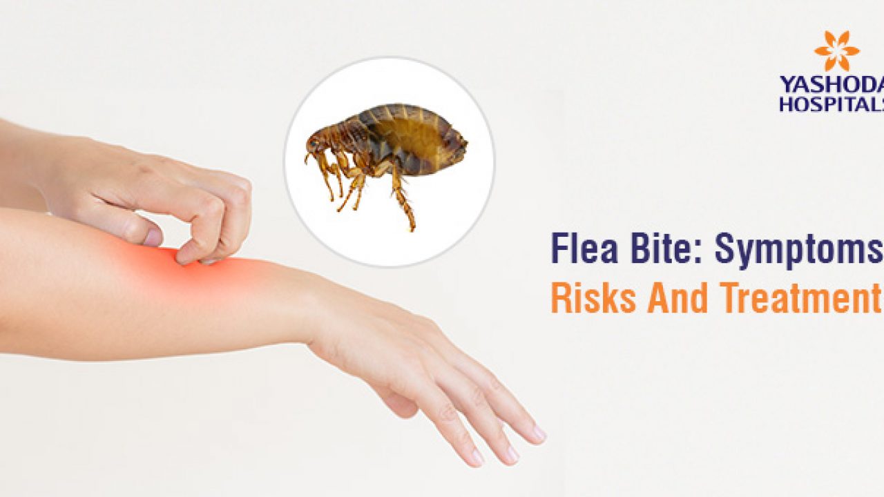 flea bites pictures