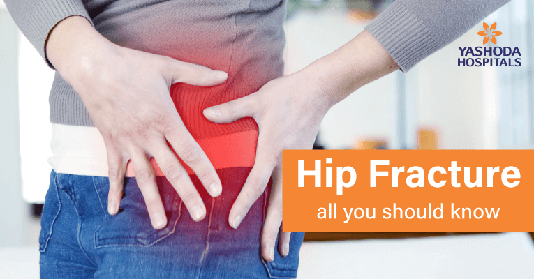 hip-fracture-types-symptoms-causes-risk-factors-diagnosis-and