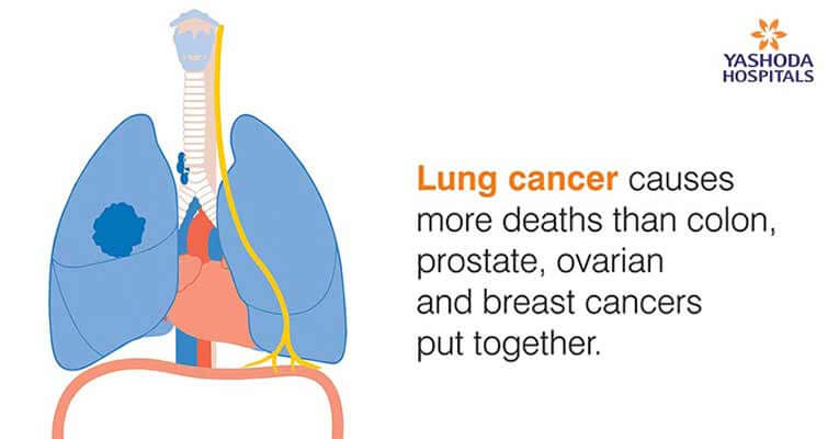 lung cancer causes more deaths