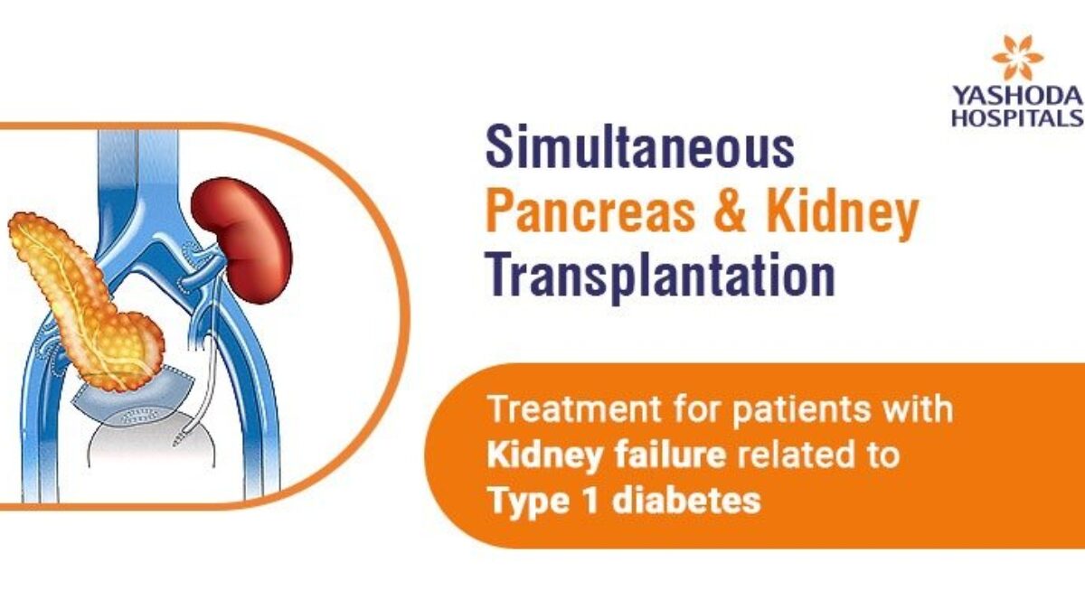 Simultaneous pancreas kidney transplantation   Yashoda Hospitals