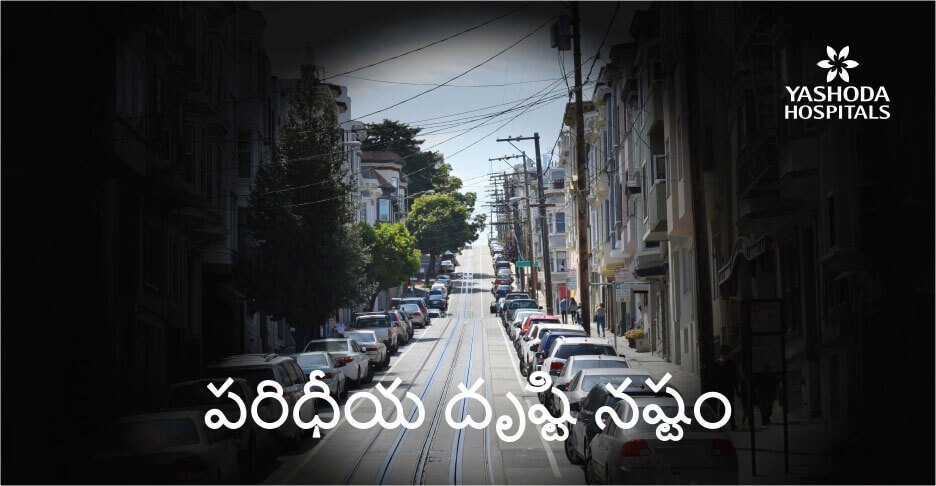 పరిధీయ దృష్టి నష్టం (peripheral vision loss) రోజువారీ జీవితాన్ని ఎలా ప్రభావితం చేస్తుంది?