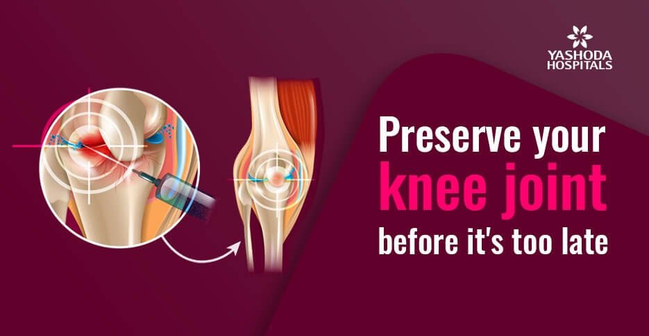 Knee joint preservation – Why and how its done?