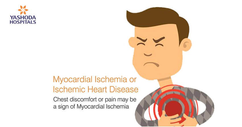 Don’t ignore discomfort or pain in chest, a sign of myocardial ischemia