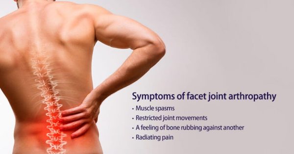 facet-joint-arthropathy-symptoms-causes-prevention-and-treatment