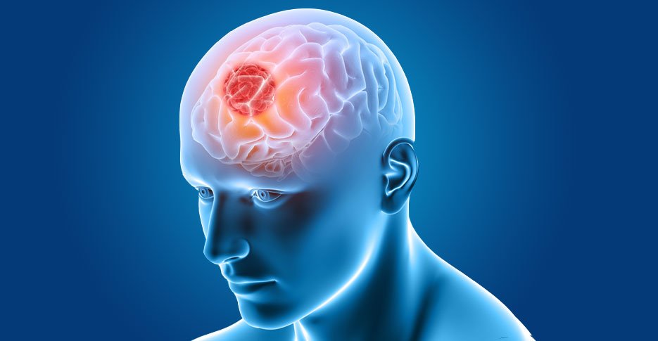 Understanding brain tumours