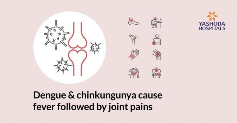 clinical presentation of viral arthritis